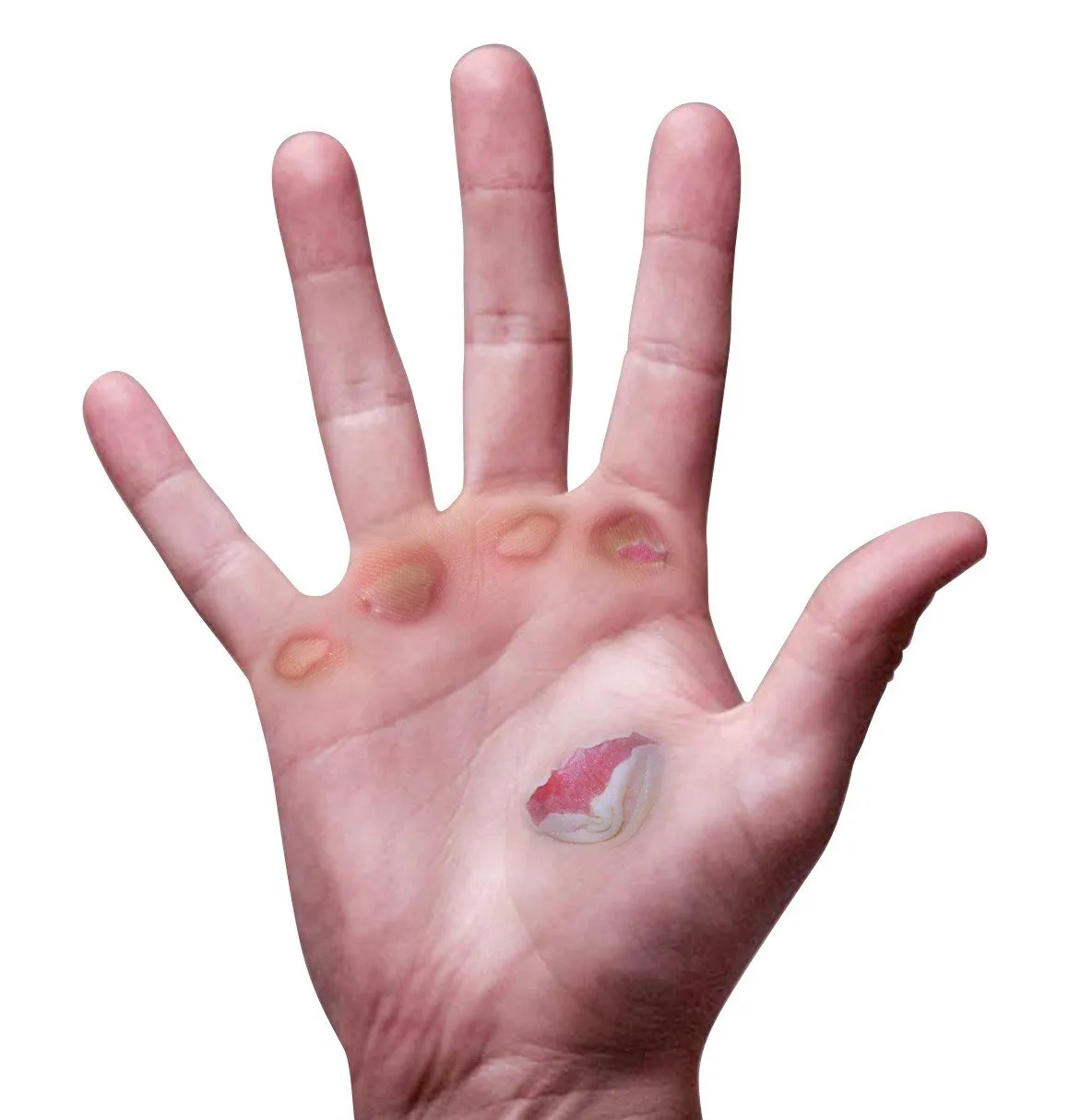 RISK RACING Palm Protectors rukavice pod rukavice proti pľuzgierom